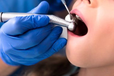 cropped shot of dentist with dental handpiece working with teeth of little kid clipart
