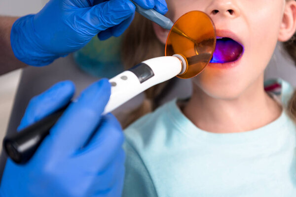 cropped shot of dentist performing dental curing procedure for little child