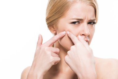 mutsuz genç kadın yüzünde sivilce sıkma ve beyaz izole kamera bakıyor