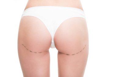 cropped shot of woman in underwear with correction marks on buttocks isolated on white