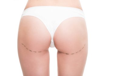 cropped shot of woman in underwear with correction marks on buttocks isolated on white clipart