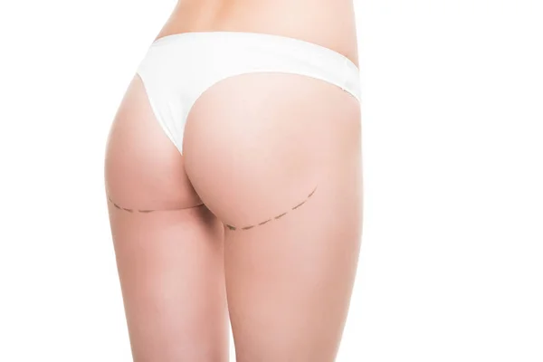 Cropped Shot Female Buttocks Correction Marks Isolated White — Stock Photo, Image