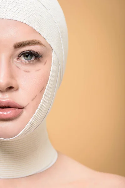 cropped shot of woman with bandages over head and correcting marks on face looking at camera isolated on beige