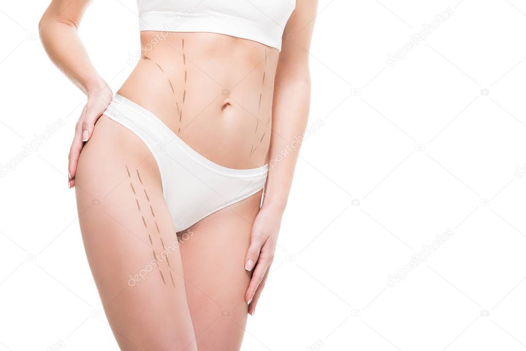 cropped shot of woman in underwear with correction marks on body isolated on white 
