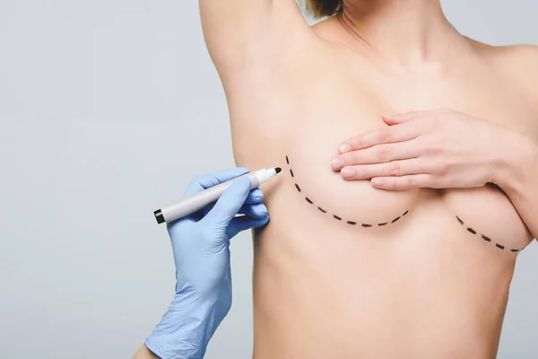 裁剪的意见 整形外科医生在乳胶手套标记线下的乳房 隔离在灰色 — 图库照片