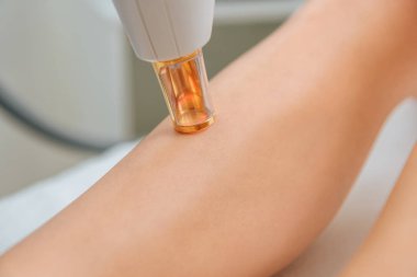 Partial view of woman receiving laser treatment on leg clipart