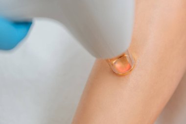 Bacak üzerinde lazer tedavi gören kadının kısmi görünümü