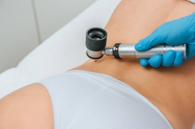 Köstebek çıkarma işlemi sırasında doktorun büyüteç kullandığına dair kırpılmış görüş