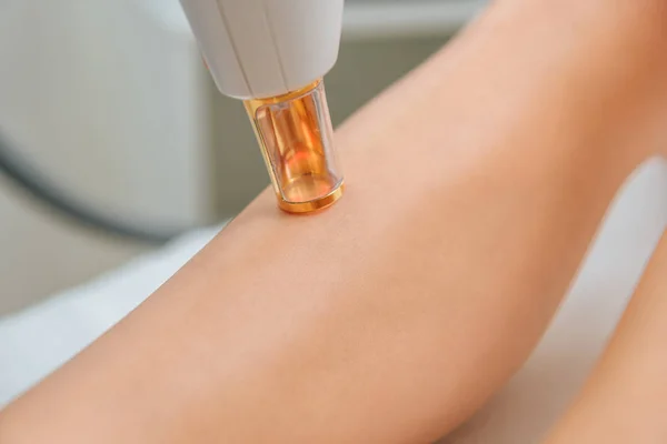 Częściowy Widok Kobiety Otrzymujących Leczenie Laserem Nogi — Zdjęcie stockowe