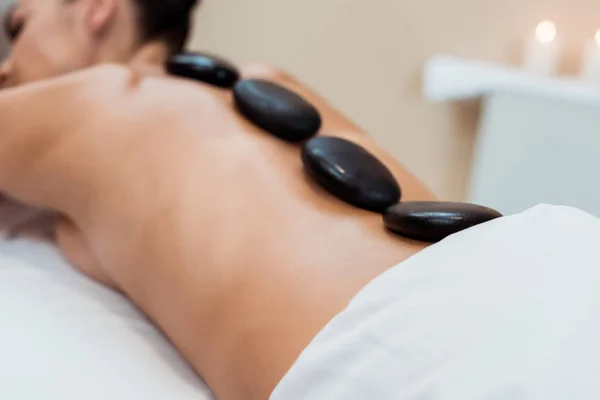 Vista parcial de la mujer joven teniendo masaje de piedra caliente en el salón de spa — Stock Photo