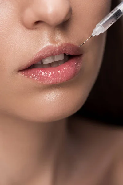 Primer plano de la mujer haciendo inyección de belleza en los labios - foto de stock