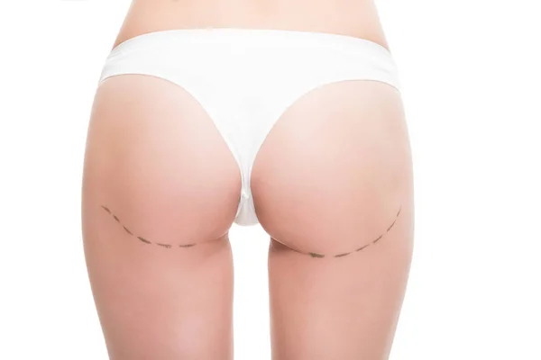 Colpo ritagliato di donna in biancheria intima con segni di correzione su glutei isolati su bianco — Foto stock