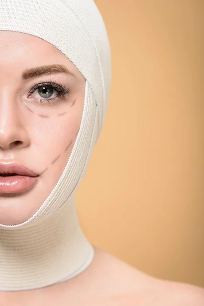 Cropped shot of woman with bandages over head and correcting marks on face looking at camera isolated on beige — Stock Photo