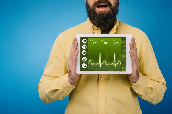 Vista recortada del hombre barbudo conmocionado que muestra tableta digital con datos de salud, aislado en azul - foto de stock