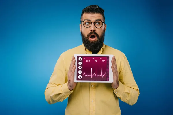 Homem barbudo chocado apresentando tablet digital com dados de saúde, isolado em azul — Fotografia de Stock