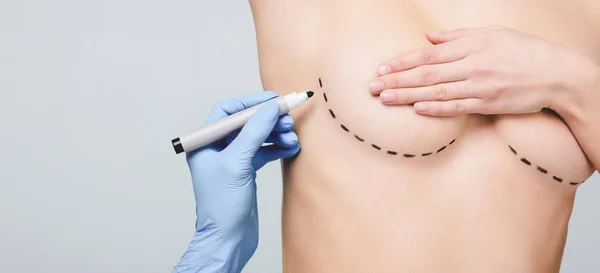 Cropped view of plastic surgeon marking lines under breast, isolated on grey — Stock Photo