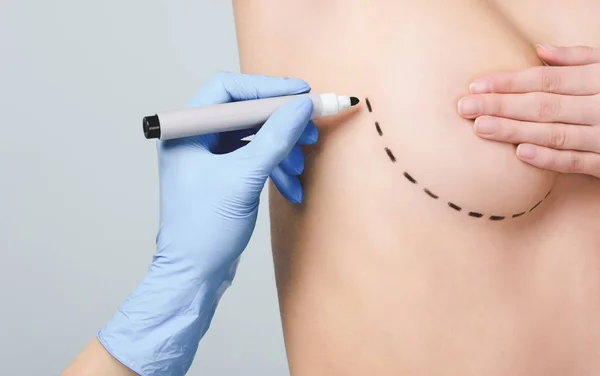 Cropped view of doctor marking lines under breast for plastic surgery, isolated on grey — Stock Photo