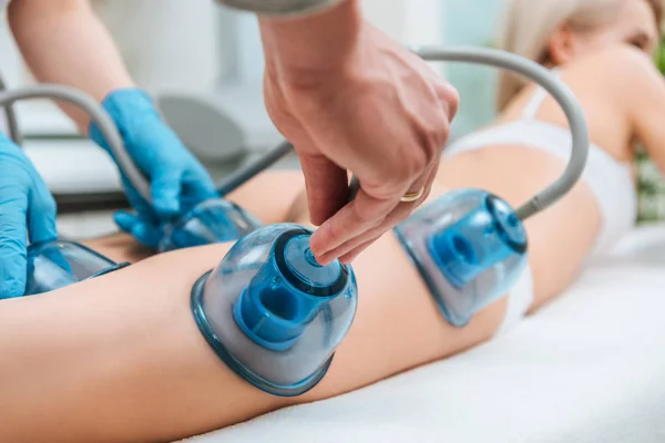 Cropped view of cosmetologist with cupping cups doing starvac treatment — Stock Photo