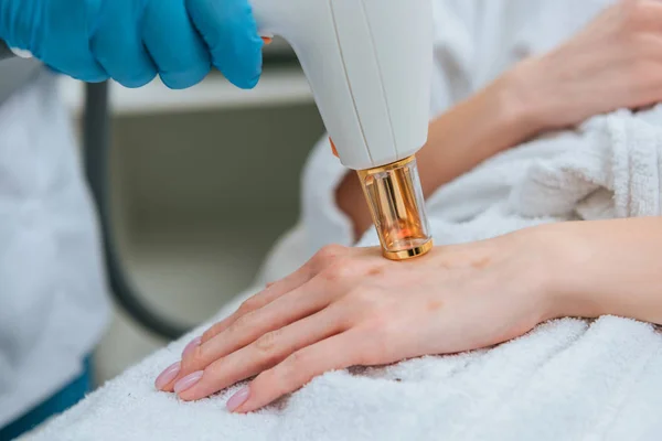 Vista recortada del cosmetólogo en guantes de goma haciendo tratamiento láser - foto de stock