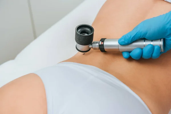 Cropped view of doctor using magnifier during mole removal procedure — Stock Photo