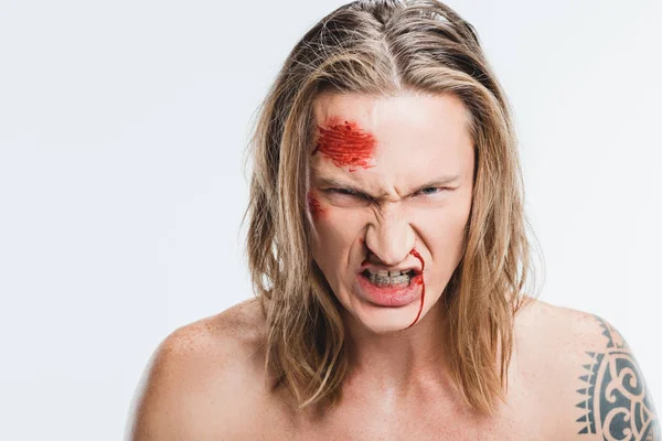 Close Homem Zangado Com Feridas Sangrentas Rosto Mostrando Dentes Isolados — Fotografia de Stock Grátis