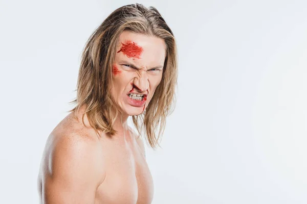 Angry Man Bloody Wounds Face Showing Teeth Isolated White — Free Stock Photo
