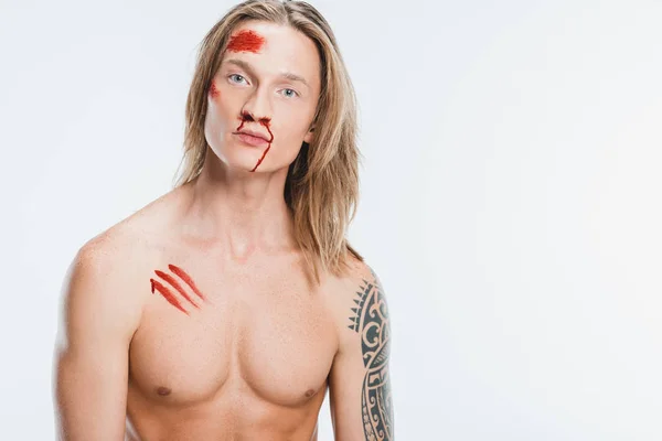 Naked Handsome Man Bloody Wounds Skin Isolated White — Stock Photo, Image