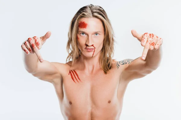 Bonito Homem Com Feridas Sangrentas Mostrando Dedos Meio Isolado Branco — Fotografia de Stock Grátis