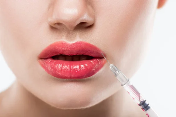 Partial view of woman with syringe making beauty injection in lips, isolated on white — Stock Photo