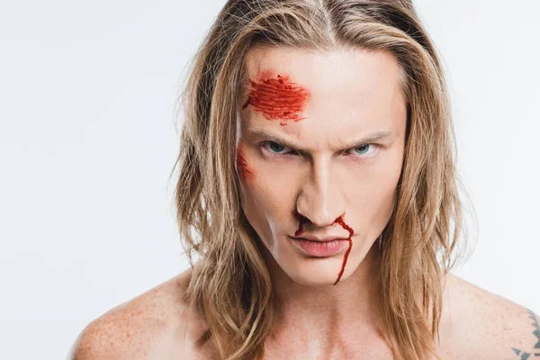 Primo piano di uomo arrabbiato con ferite sanguinose sul viso isolato su bianco — Foto stock