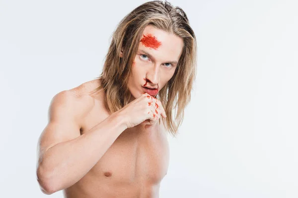 Homme adulte avec des ecchymoses sur le visage essuyant le sang isolé sur blanc — Photo de stock