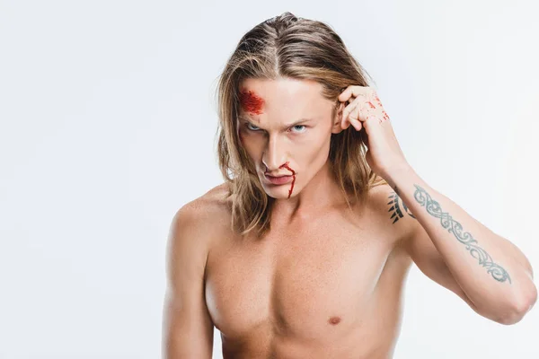 Homme adulte avec des ecchymoses sanglantes sur le visage touchant les cheveux isolés sur blanc — Photo de stock