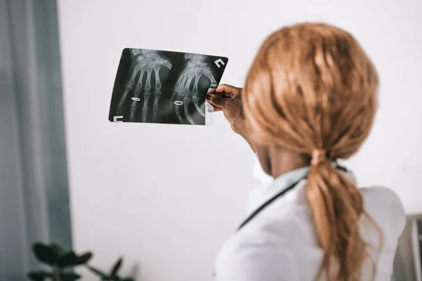 Doctora afroamericana mirando rayos X en clínica - foto de stock