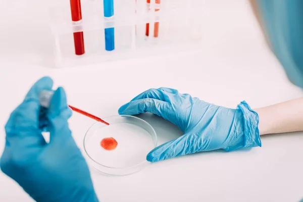 Vista parcial de la científica haciendo análisis de sangre en laboratorio - foto de stock