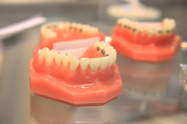 Dental prosthetic model. Anatomy model of a human jaw. Artificial human jaw with teeth.