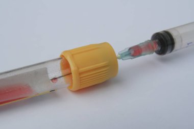 Bir tüp kan örneği. Laboratuvar test tüpü insan kan örneği ile dolu.