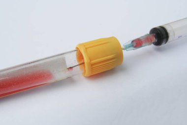 Bir tüp kan örneği. Laboratuvar test tüpü insan kan örneği ile dolu.