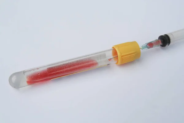 テスト チューブ内の血液サンプルです 実験室の試験管はヒトの血液サンプルでいっぱい — ストック写真