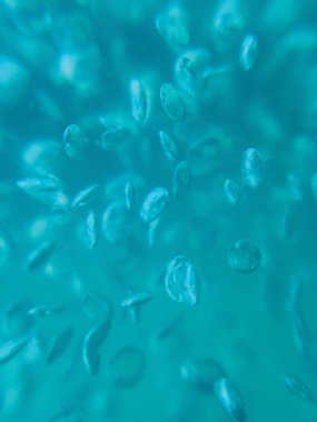 sıvı hava kabarcıkları arka plan