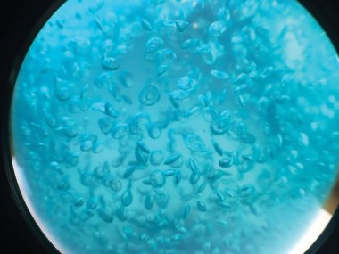 sıvı hava kabarcıkları arka plan