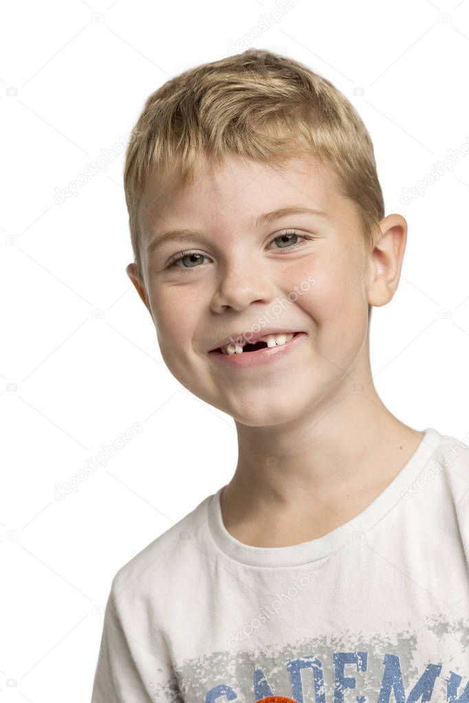 Cute little boy without anterior teeth laughing, close-up