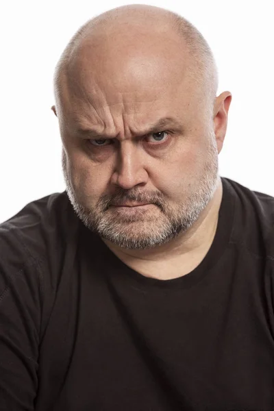 Bald Man Angry Facial Expression Close — Stock Photo, Image