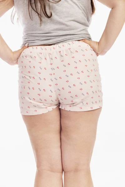 Pernas femininas grossas com celulite, isoladas em fundo branco — Fotografia de Stock