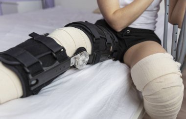 Kadın bacak diz cerrahisi bandaj ve Ortez, yakın çekim sonra