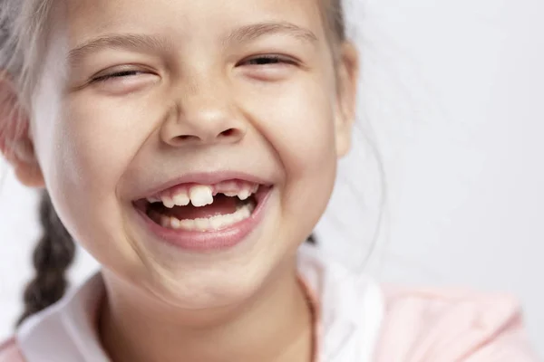 Dívka školního věku bez předního zubu se směje. Close-up. Změna zubů. — Stock fotografie