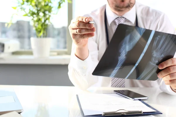 Homme médecin tenir dans le bras stylo en argent et regarder les rayons X — Photo