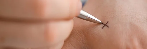 Masculino fazer x cruz nota com prata caneta no seu braço — Fotografia de Stock