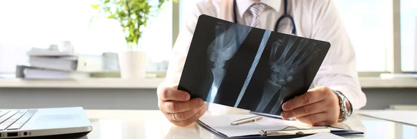 Male doctor hold in arm silver pen and look at xray — Stock Photo, Image