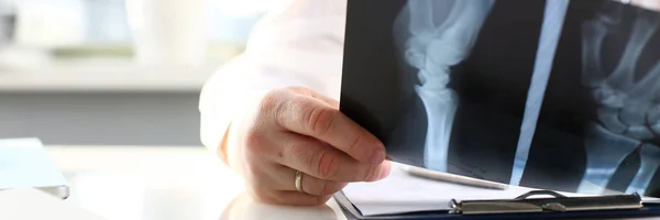 Homme médecin tenir dans le bras stylo en argent et regarder les rayons X — Photo