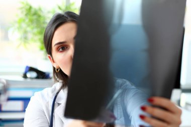 Kadın güzel Doktor kolundan basılı tutarak xray bak